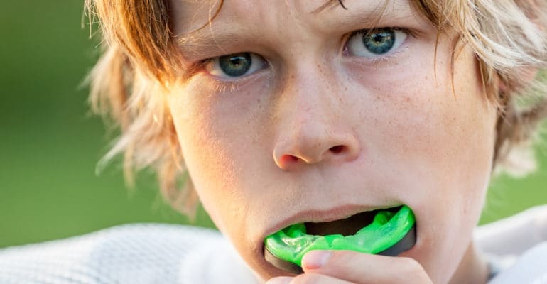 5 Benefits of a Professionally Fitted Mouthguard