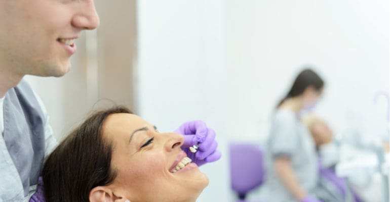 dental veneers