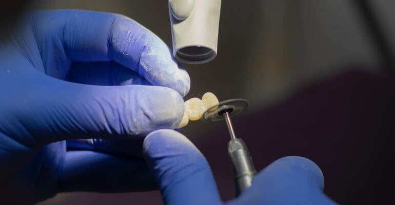 teeth